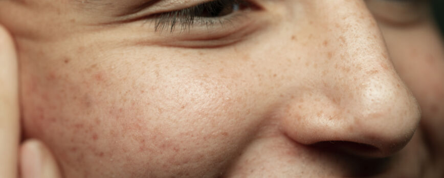 Close da textura da pele do jovem sorridente