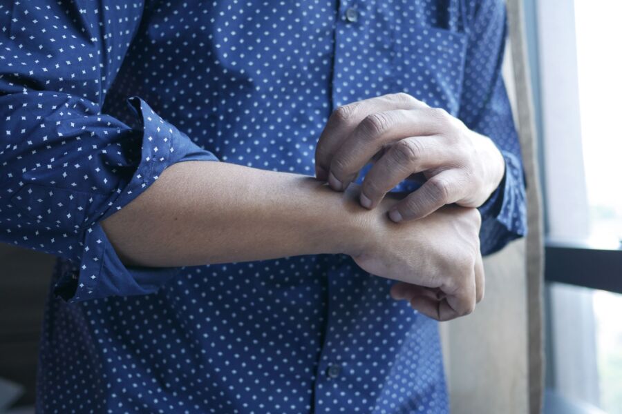 Um homem com uma camisa de bolinhas coçando o braço ao lado de uma janela, simbolizando desconforto ou irritação.